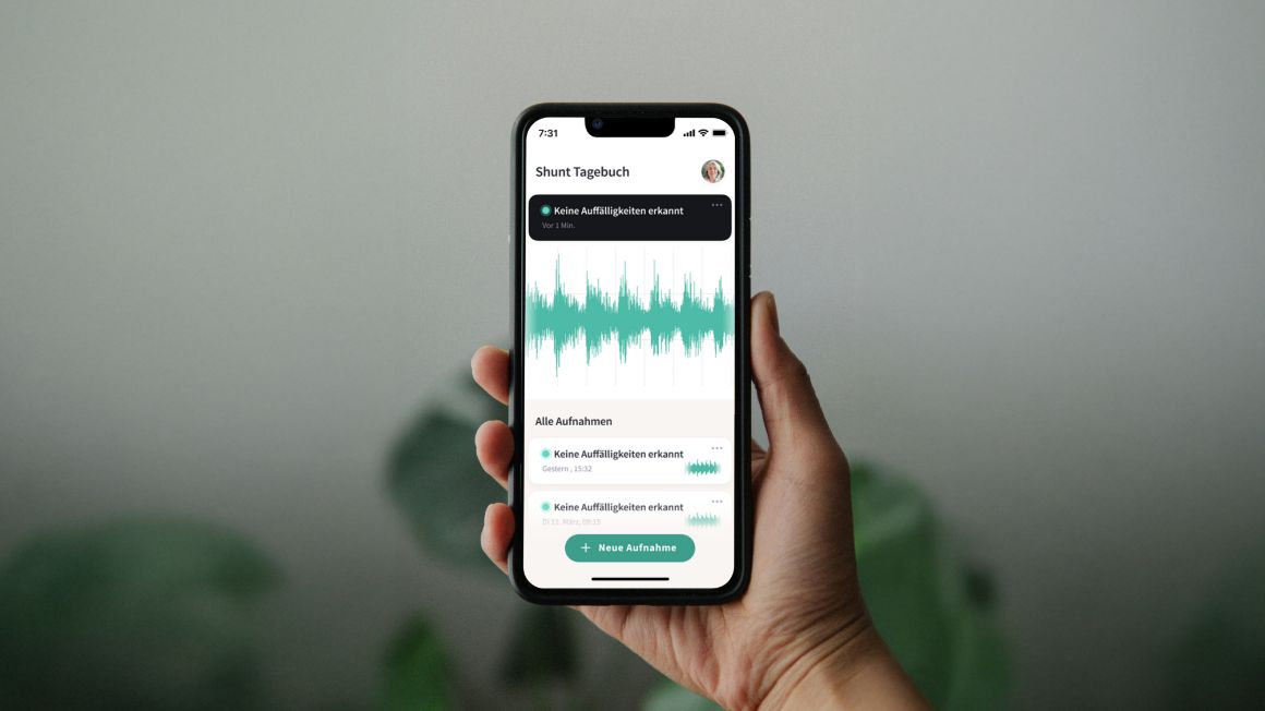 Hand, die ein Smartphone hält, auf dem eine App geöffnet ist. In der App ist ein Diagramm zu sehen und verschiedene Einträge eines "Shunt Tagebuchs".
